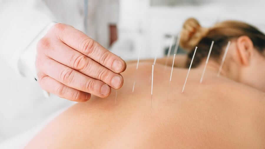 Acupuncture is totally pain free
