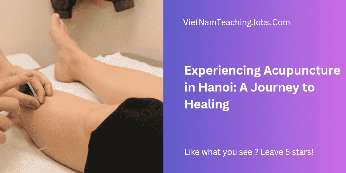 Experiencing Acupuncture in Hanoi: A Journey to Healing